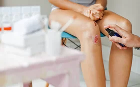 Eine Person lässt ihr verletztes Knie desinfizieren und verarzten.