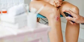 Eine Person lässt ihr verletztes Knie desinfizieren und verarzten.