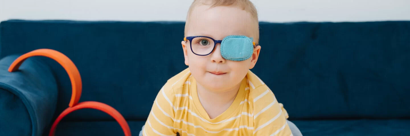 Ein Kleinkind trägt eine Brille, und ein Auge ist mit einem Pflaster zugeklebt. Amblyopie ist eine häufige Sehstörung bei Kindern. 