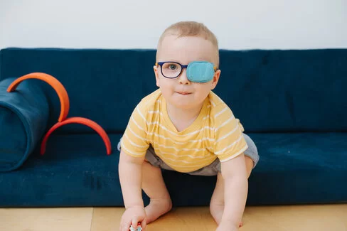 Ein Kleinkind trägt eine Brille, und ein Auge ist mit einem Pflaster zugeklebt. Amblyopie ist eine häufige Sehstörung bei Kindern. 