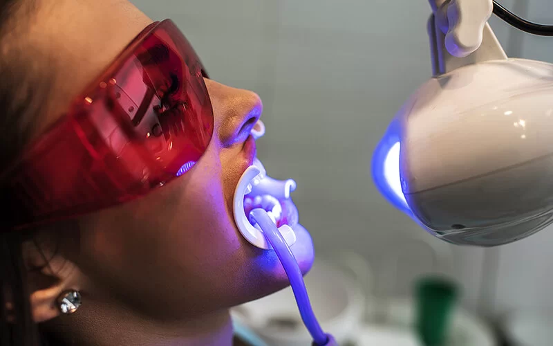 Eine Frau bei einer zahnärztlichen Behandlung. Sie trägt eine Schiene im Mund und eine Schutzbrille auf den Augen. Ihre Zähne werden mit UV-Licht angestrahlt.