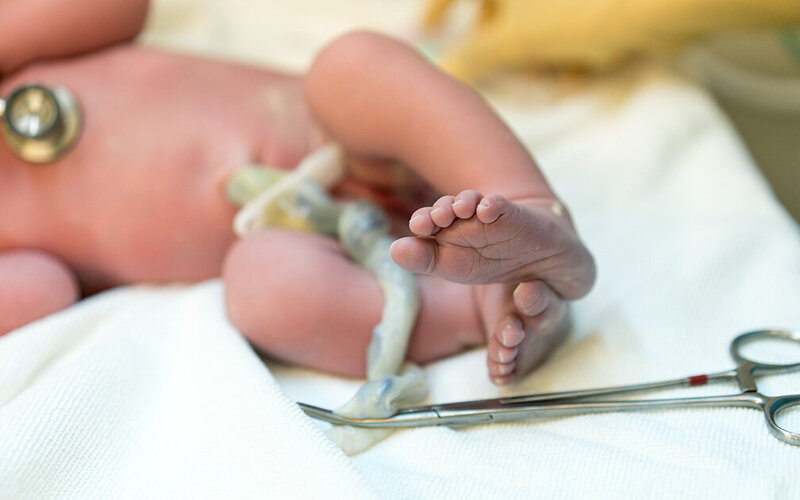 Ein Neugeborenes liegt auf einem weißen Tuch – die Nabelschnur ist durchtrennt, die Nabelpflege kann beginnen.