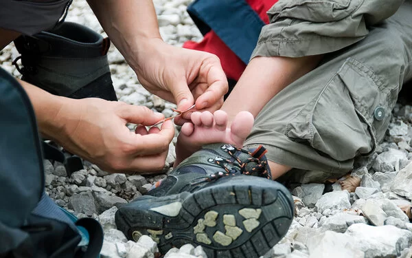 Eine Person klebt einer anderen Person ein Pflaster auf eine Blase, die beim Wandern entstanden ist.