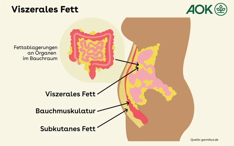 Die Grafik zeigt einen Querschnitt durch den menschlichen Körper. Zu sehen ist der Bauchraum, in dem das viszerale Fett, das subkutane Fett und die Bauchmuskulatur dargestellt sind. Das viszerale Fett befindet sich im gesamten Bauchraum, zwischen den Organen.