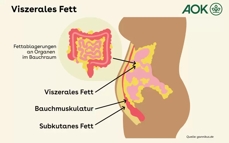Die Grafik zeigt einen Querschnitt durch den menschlichen Körper. Zu sehen ist der Bauchraum, in dem das viszerale Fett, das subkutane Fett und die Bauchmuskulatur dargestellt sind. Das viszerale Fett befindet sich im gesamten Bauchraum, zwischen den Organen.