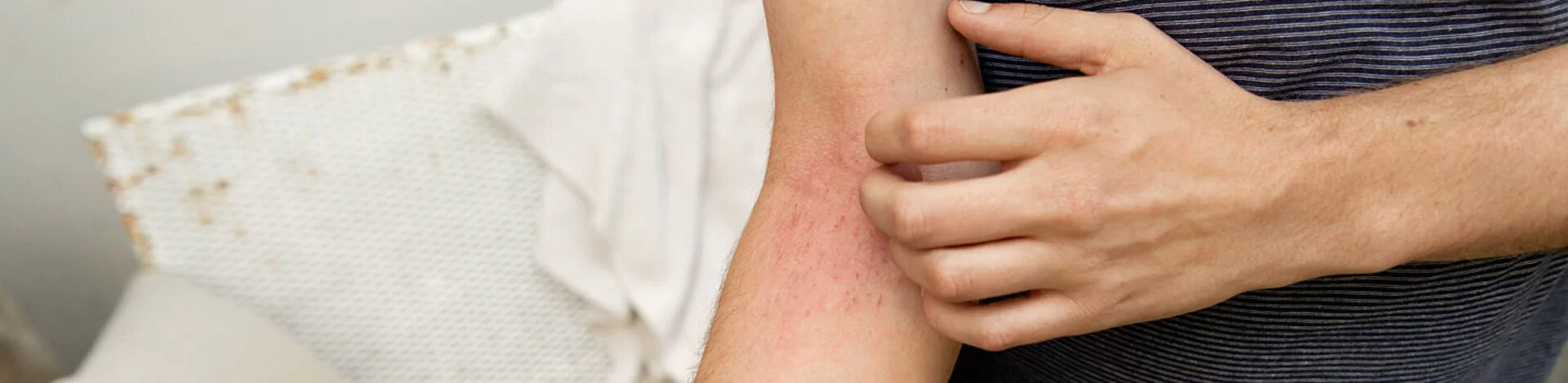 Eine Person kratzt sich am Arm. Dahinter kann eine Kontaktallergie stecken.
