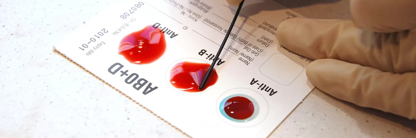 Eine Person mit Latexhandschuhen testet eine Blutprobe auf ihre Blutgruppe.
