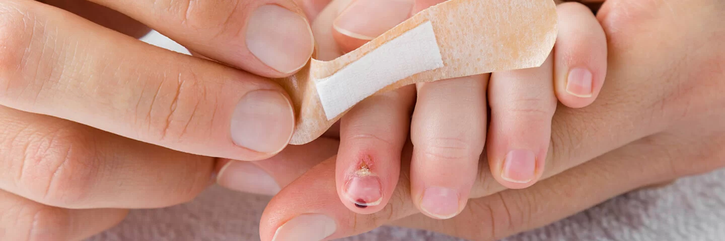Erwachsene Person klebt einem Kind ein Pflaster auf eine eitrige Wunde am Finger.
