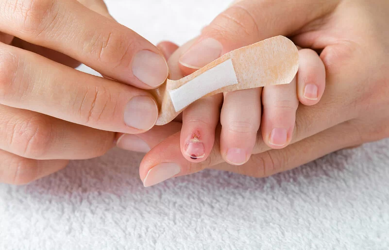 Erwachsene Person klebt einem Kind ein Pflaster auf eine eitrige Wunde am Finger.
