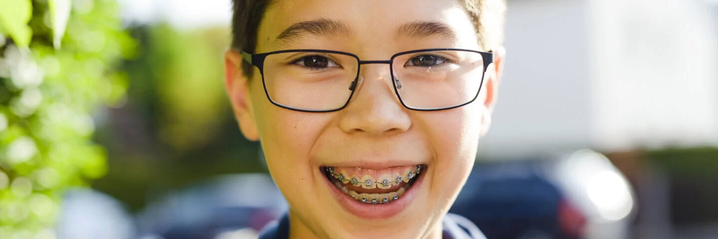 Ein Junge trägt eine feste Zahnspange. Einen Teil der Kosten übernimmt die AOK. 
