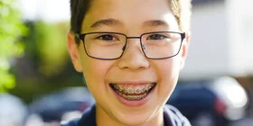 Ein Junge trägt eine feste Zahnspange. Einen Teil der Kosten übernimmt die AOK. 