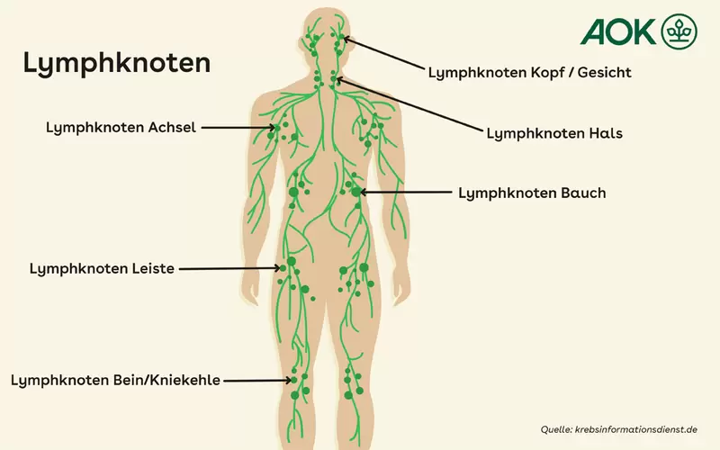 Grafik zum menschlichen Lymphsystem und zur Lage der Lymphknoten.
