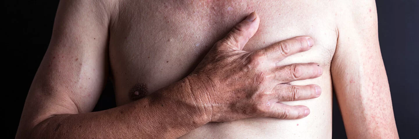 Mann mit nacktem Oberkörper legt die rechte Hand tastend auf die linke Brust.