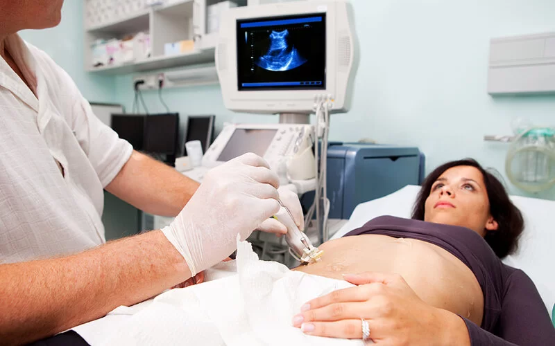 Ein Arzt entnimmt unter Ultraschallkontrolle eine Probe von der Leber einer Patientin.