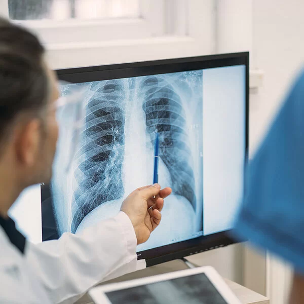 Ein Arzt schaut auf einen Bildschirm und analysiert die radiologische Aufnahme von einem Brustkorb. Mit einem Stift zeigt er auf Rippen und Lunge.