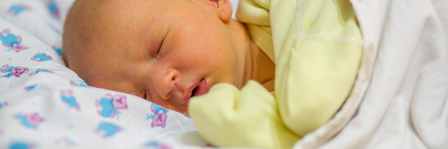 Baby mit gelber Färbung der Haut aufgrund einer Neugeborenengelbsucht