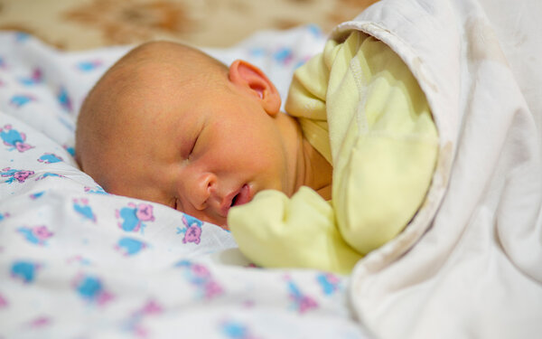Baby mit gelber Färbung der Haut aufgrund einer Neugeborenengelbsucht
