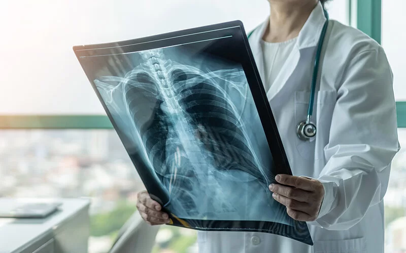 Eine Frau im weißen Kittel hält eine Röntgenaufnahme in den Händen.