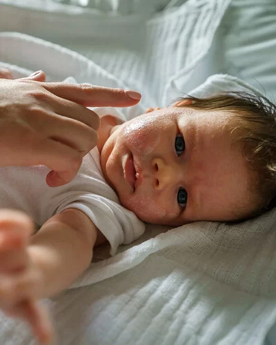 Eine Frau cremt das Gesicht eines Babys mit Neurodermitis ein.