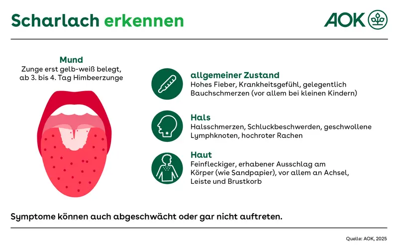 Die Infografik zeigt die Symptome von Scharlach. Sie ist in fünf Abschnitte unterteilt: Kopf, Hals, Haut, Bauch und Mund. Jeder Abschnitt listet die mit diesem Körperteil verbundenen Symptome auf.