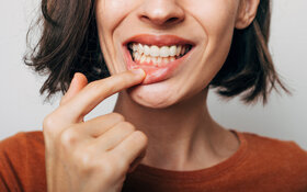 Eine Frau zeigt ihr gesundes Zahnfleisch.
