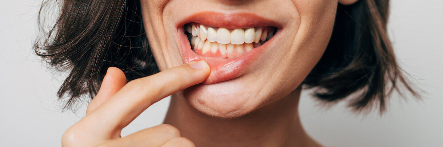 Eine Frau zeigt ihr gesundes Zahnfleisch.