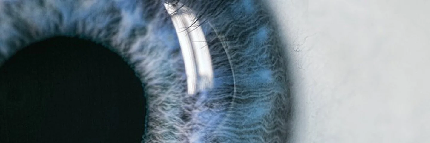 Auf dem Bild ist ein Teil eines Auges zu erkennen. Die Pupille ist groß und schwarz, die Iris bläulich gefärbt.