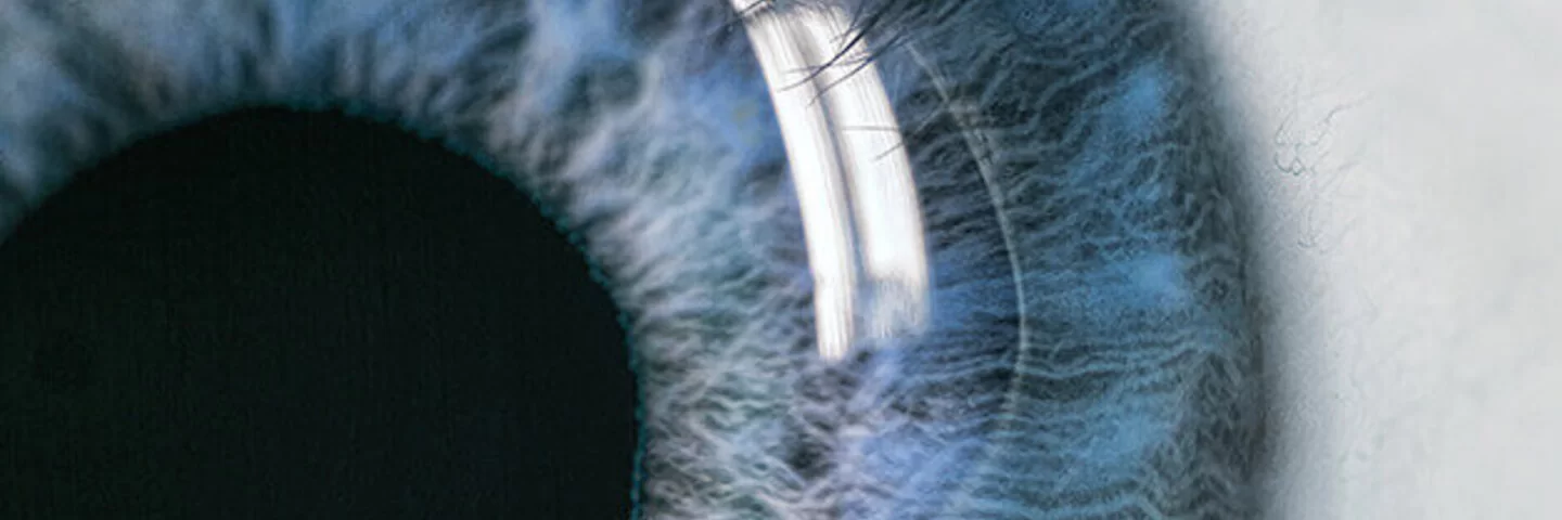 Auf dem Bild ist ein Teil eines Auges zu erkennen. Die Pupille ist groß und schwarz, die Iris bläulich gefärbt. 