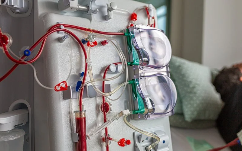 Dialyse-Apparat neben einem Patienten im Klinikbett.