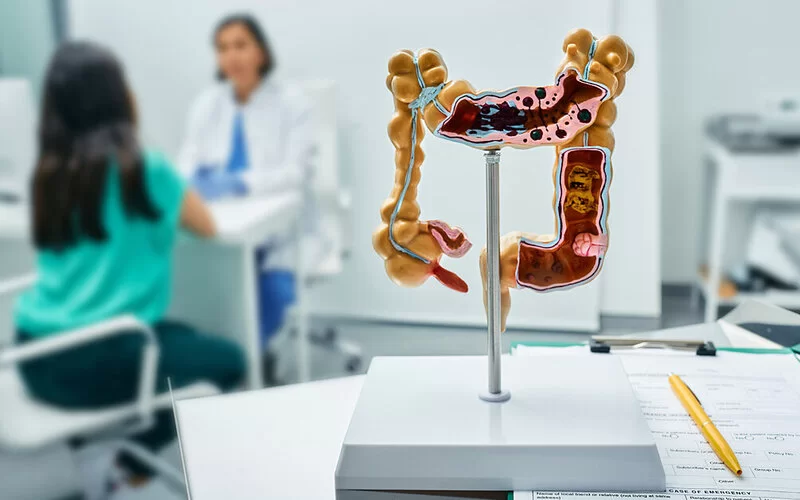 In einer Arztpraxis steht ein Modell eines Dickdarms im Vordergrund auf einem Tisch, ein Ärztegespräch im Hintergrund.