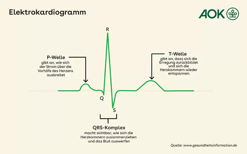 Grafik zur EKG-Welle und deren unterschiedlichen Abschnitten.