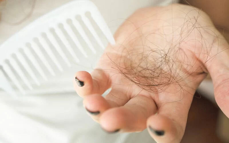 Frau verliert Haarbüschel, Haarausfall ist kein reines Männerproblem