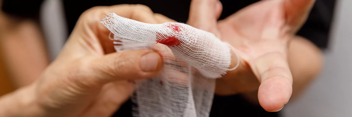 Mann mit Hämophilie lässt Wunde am Finger verbinden.