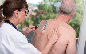 Ärztin untersucht mit einer Lupe den Rücken eines älteren Mannes mit hellen Hautveränderungen.