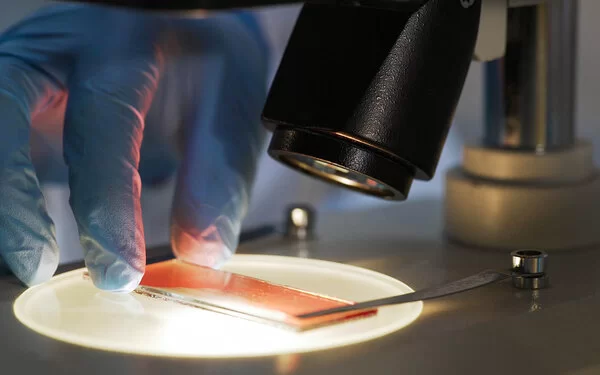 Unter dem Mikroskop wird eine Blutprobe für die Stammzellenspende analysiert.