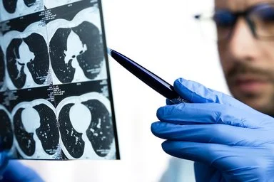 Nahaufnahme eines Arztes, der eine CT-Untersuchung der Lunge eines Patienten betrachtet.