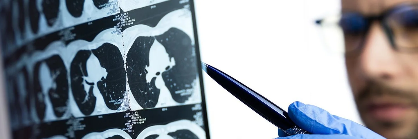 Nahaufnahme eines Arztes, der eine CT-Untersuchung der Lunge eines Patienten betrachtet.