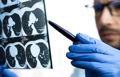 Nahaufnahme eines Arztes, der eine CT-Untersuchung der Lunge eines Patienten betrachtet.