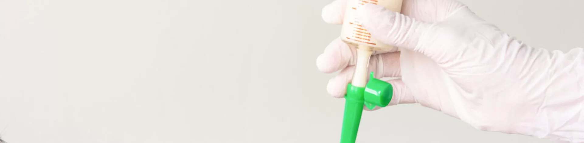 Ob Patienten von künstlicher Ernährung profitieren, hängt von vielen Faktoren ab. Die AOK gibt eine Entscheidungshilfe.