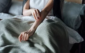 Eine junge Frau sitzt im Bett und fasst sich auf ihre von Nesselsucht befallene Haut am Arm.