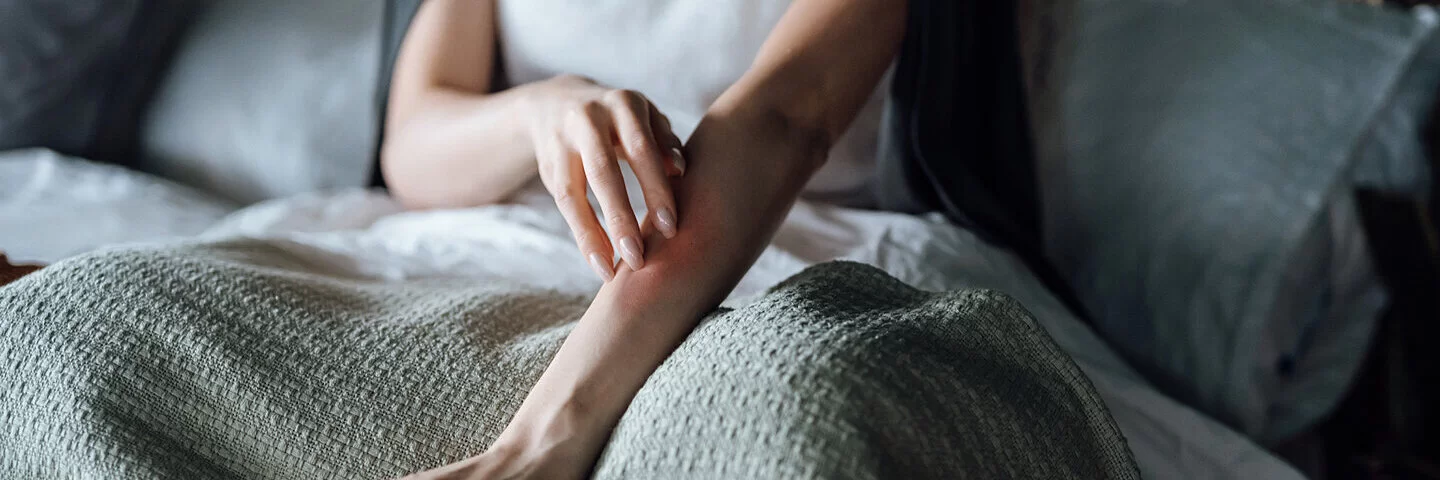 Eine junge Frau sitzt im Bett und fasst sich auf ihre von Nesselsucht befallene Haut am Arm.