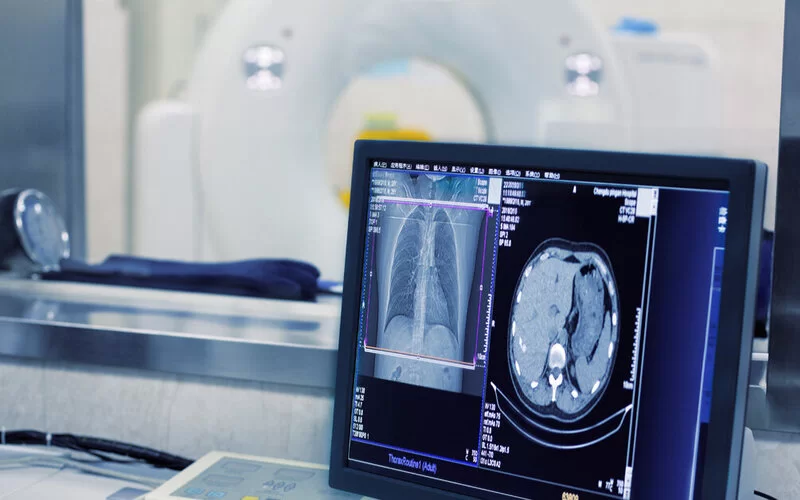 Ein CT-Gerät in einem Krankenhaus, zu sehen sind Aufnahmen des menschlichen Körpers.