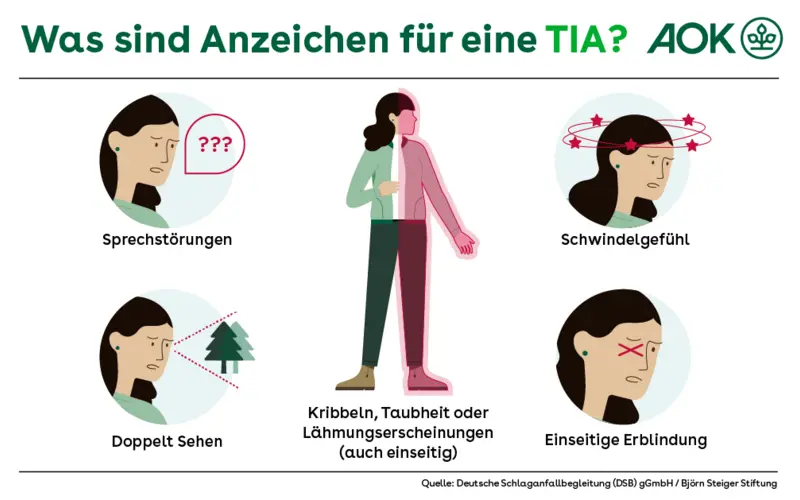 Abgebildet sind Anzeichen für eine TIA: Kribbeln, Taubheit oder Lähmungserscheinungen in Arm, Bein oder einer Körperhälfte, Sprach- oder Sprechstörungen, Schwindelgefühl, doppelt Sehen, einseitige Erblindung