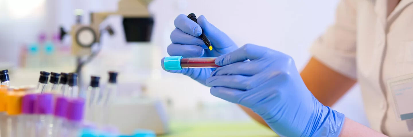 Eine Frau im Labor beschriftet eine Blutprobe.