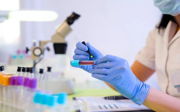 Eine Frau im Labor beschriftet eine Blutprobe.