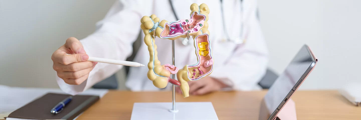 Auf dem Tisch einer Ärztin steht ein anatomisches Modell eines menschlichen Darms. Ihr Oberkörper ist verschwommen im Hintergrund zu sehen. Mit einem Stift zeigt sie auf das Modell.