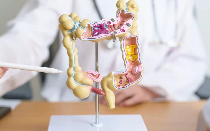 Auf dem Tisch einer Ärztin steht ein anatomisches Modell eines menschlichen Darms. Ihr Oberkörper ist verschwommen im Hintergrund zu sehen. Mit einem Stift zeigt sie auf das Modell.