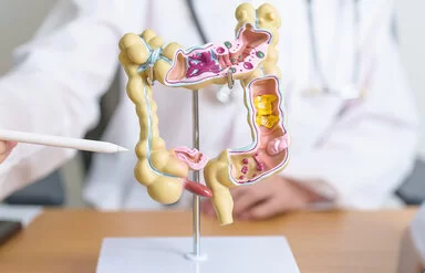 Auf dem Tisch einer Ärztin steht ein anatomisches Modell eines menschlichen Darms. Ihr Oberkörper ist verschwommen im Hintergrund zu sehen. Mit einem Stift zeigt sie auf das Modell.