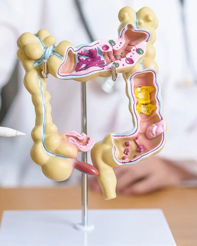 Auf dem Tisch einer Ärztin steht ein anatomisches Modell eines menschlichen Darms. Ihr Oberkörper ist verschwommen im Hintergrund zu sehen. Mit einem Stift zeigt sie auf das Modell.
