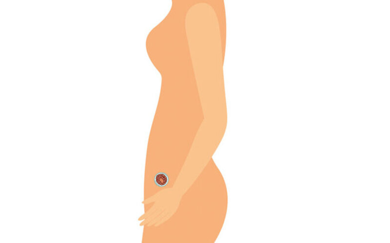 Eine schwangere Frau mit einem Fötus im Bauch.